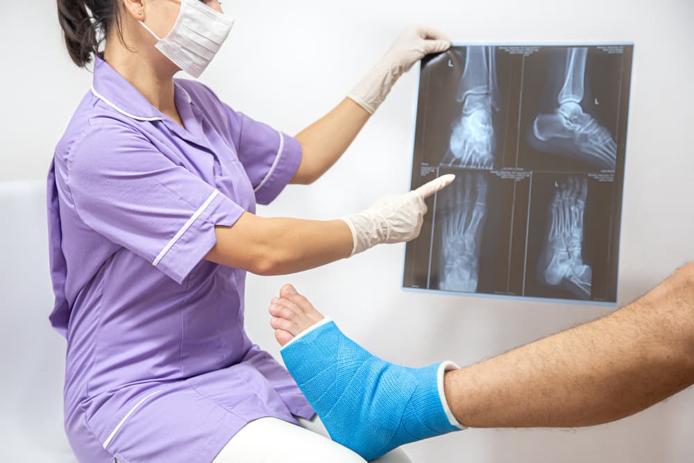 Doctor explaining an X-ray scan of a fractured bone to a patient at the Orthopedics and Traumatology Department of Prakash Hospital.